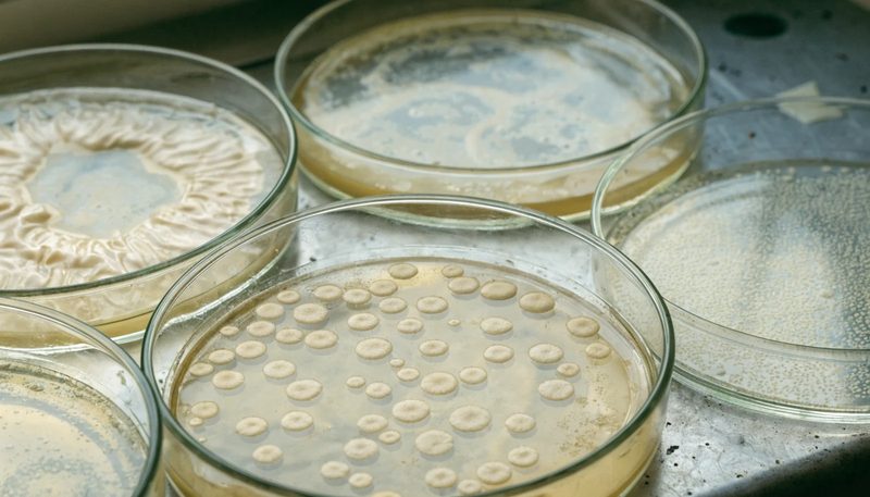 Several agar plates carrying visibly different bacterial colony forms.